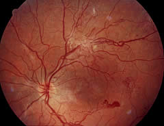 Augenarzt Uslar - Fachpraxis für Augenheilkunde